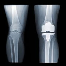 Рубрика: Медицинские импланты