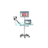 Видеокольпоскоп модели EDAN C6A HD для гинекологии