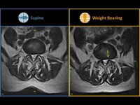 Esaote G-Scan Magnit-rezonans tomografiya (MRT) apparati