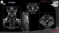 Магнитно-резонансный томограф (МРТ) открытого типа Esaote Magnifico