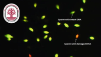 DNK parchalanishi bilan kengaytirilgan spermogramma (Kruger bo'yicha, JSST bo'yicha) -ИЗРАИЛЬСКИЙ МЕДИЦИНСКИЙ ЦЕНТР РЕПРОДУКТИВНОЙ МЕДИЦИНЫ И СЕМЕЙНОГО ЗДОРОВЬЯ